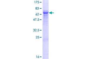 Image no. 1 for Trophoblast Glycoprotein (TPBG) (AA 1-420) protein (GST tag) (ABIN1323405) (TPBG Protein (AA 1-420) (GST tag))