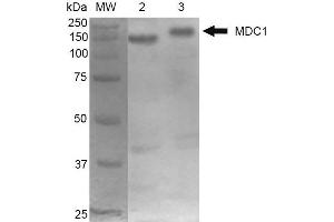 Western Blot analysis of Mouse Cortex and Cerebellum showing detection of 184 kDa MDC1 protein using Mouse Anti-MDC1 Monoclonal Antibody, Clone P2B11 . (MDC1 Antikörper  (N-Term) (PE))