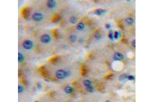 Used in DAB staining on fromalin fixed paraffin-embedded Liver tissue (CSF1R Antikörper  (AA 768-928))