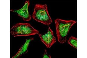 Fluorescent confocal image of HeLa cell stained with ATF7 antibody at 1:25. (ATF7 Antikörper  (AA 68-96))