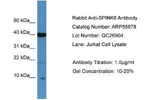 WB Suggested Anti-SPINK6  Antibody Titration: 0.