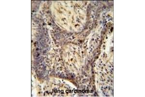 Immunohistochemistry (Paraffin-embedded Sections) (IHC (p)) image for anti-Peroxisome Proliferator-Activated Receptor Gamma, Coactivator-Related 1 (PPRC1) (AA 1636-1664), (C-Term) antibody (ABIN654964)