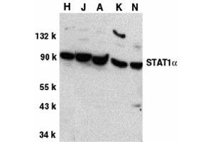 Western Blotting (WB) image for anti-Signal Transducer and Activator of Transcription 1, 91kDa (STAT1) (C-Term) antibody (ABIN1030701) (STAT1 Antikörper  (C-Term))