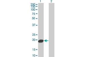 Western Blot analysis of UBE2C expression in transfected 293T cell line by UBE2C monoclonal antibody (M04), clone 3B1. (UBE2C Antikörper  (AA 1-179))