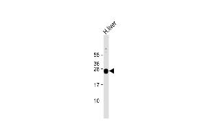 Anti-GSTA5 Antibody (N-Term) at 1:2000 dilution + human liver lysate Lysates/proteins at 20 μg per lane.