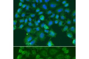 Immunofluorescence analysis of A549 cells using CST1 Polyclonal Antibody (CST1 Antikörper)