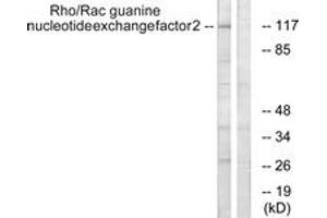 Western blot analysis of extracts from NIH-3T3 cells, using Rho/Rac Guanine Nucleotide Exchange Factor 2 (Ab-885) Antibody. (ARHGEF2 Antikörper  (AA 851-900))