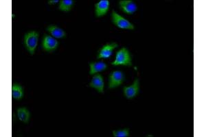 Immunofluorescence staining of A549 cells with ABIN7158492 at 1:100, counter-stained with DAPI. (SLC27A1 Antikörper  (AA 453-570))