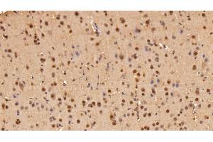 Immunohistochemistry (IHC) image for anti-Adhesion Regulating Molecule 1 (Adrm1) (AA 2-407) antibody (ABIN7443221)