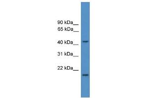 WB Suggested Anti-SCCPDH Antibody Titration: 0. (SCCPDH Antikörper  (Middle Region))