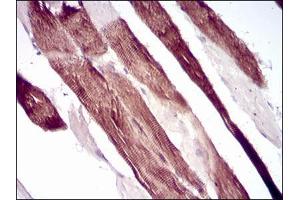 Immunohistochemical analysis of paraffin-embedded muscle tissues using VIL1 mouse mAb with DAB staining.