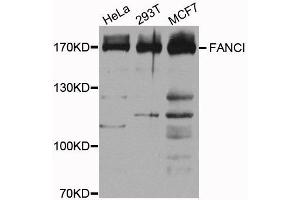 Western blot analysis of extracts of various cells, using FANCI antibody. (FANCI Antikörper)