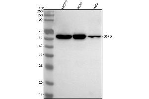 Western blot analysis of G6PD using anti-G6PD antibody (ABIN7604907).