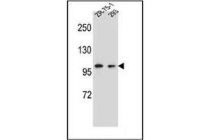 Western blot analysis of GRIP2 Antibody (Center) in ZR-75-1,293 cell line lysates (35ug/lane). (GRIP2 Antikörper  (Middle Region))