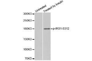 Western blot analysis of extract from 293 cells, using phospho-IRS1-S312 antibody (ABIN2987536). (IRS1 Antikörper  (pSer312))
