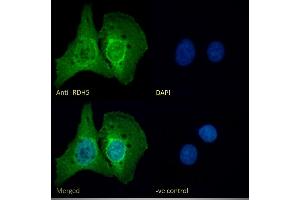 (ABIN571175) Immunofluorescence analysis of paraformaldehyde fixed U2OS cells, permeabilized with 0. (RDH5 Antikörper  (AA 19-31))