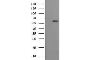Western Blotting (WB) image for anti-Formiminotransferase Cyclodeaminase (FTCD) antibody (ABIN1496380) (FTCD Antikörper)