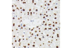 Immunohistochemistry of paraffin-embedded rat liver using HNRNPD antibody (ABIN7267632) at dilution of 1:100 (40x lens). (HNRNPD/AUF1 Antikörper  (AA 1-306))
