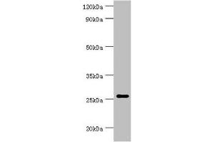 Western blot All lanes: Tumor necrosis factor ligand superfamily member 13 antibody at 10 μg/mL + Hela whole cell lysate Secondary Goat polyclonal to rabbit IgG at 1/10000 dilution Predicted band size: 28, 26, 25, 37, 23 kDa Observed band size: 28 kDa (TNFSF13 Antikörper  (AA 105-247))