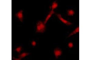 Immunofluorescent analysis of GRK2 staining in HeLa cells. (GRK2 Antikörper  (C-Term))