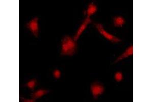 Immunofluorescent analysis of GRK2 staining in HeLa cells. (GRK2 Antikörper  (C-Term))