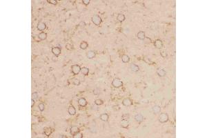 Immunohistochemistry (IHC) image for anti-Potassium Voltage-Gated Channel, Shab-Related Subfamily, Member 1 (KCNB1) (AA 687-858) antibody (ABIN3043866)