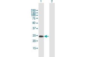 Western Blot analysis of RBPMS2 expression in transfected 293T cell line by RBPMS2 MaxPab polyclonal antibody. (RBPMS2 Antikörper  (AA 1-209))