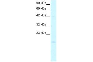 WB Suggested Anti-PFDN1 Antibody Titration:  5. (PFDN1 Antikörper  (N-Term))