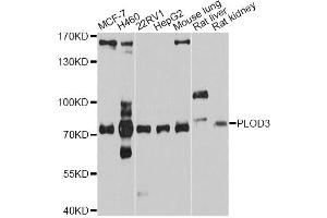 Western blot analysis of extracts of various cell lines, using PLOD3 antibody (ABIN4904792) at 1:1000 dilution. (PLOD3 Antikörper)