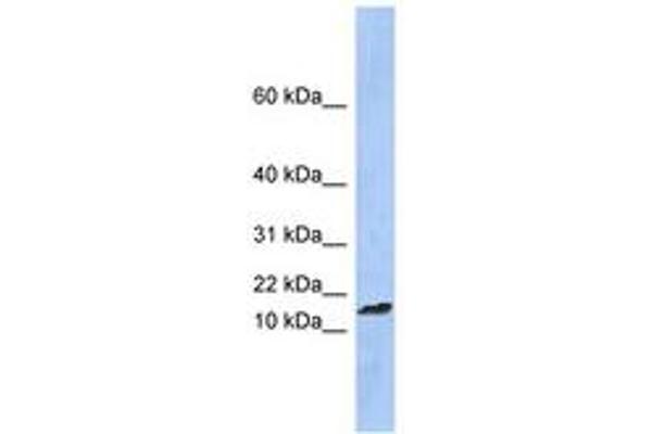 TAL2 Antikörper  (C-Term)
