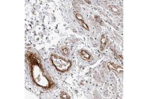 Immunohistochemical staining of human rectum with C1orf216 polyclonal antibody  shows strong positivity in endothelial cells at 1:10-1:20 dilution.