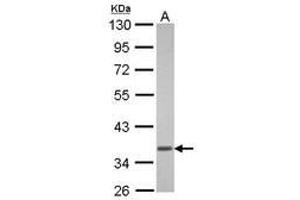 Image no. 1 for anti-Guanine Nucleotide Binding Protein (G Protein), alpha Transducing Activity Polypeptide 1 (GNAT1) (AA 37-350) antibody (ABIN1498484) (GNAT1 Antikörper  (AA 37-350))
