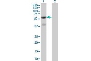 Western Blot analysis of TRAF3 expression in transfected 293T cell line by TRAF3 MaxPab polyclonal antibody. (TRAF3 Antikörper  (AA 1-568))