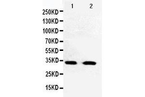 Anti-Cdk5 antibody, Western blotting Lane 1: HELA Cell Lysate Lane 2: JURKAT Cell Lysate (CDK5 Antikörper  (C-Term))