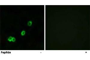 Immunofluorescence analysis of MCF-7 cells, using ACOT1 polyclonal antibody . (ACOT1 Antikörper)