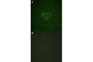 Immunofluorescence staining of methanol-fixed A-549 cells with TNK2 (phospho Y284) polyclonal antibody  without blocking peptide (A) or preincubated with blocking peptide (B) at 1:100-1:200 dilution. (TNK2 Antikörper  (pTyr284))