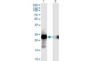 Western Blotting (WB) image for anti-Cbp/p300-Interacting Transactivator, with Glu/Asp-Rich Carboxy-terminal Domain, 1 (CITED1) (AA 94-193) antibody (ABIN518015)