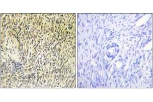 Immunohistochemistry (IHC) image for anti-Spleen tyrosine Kinase (SYK) (AA 289-338) antibody (ABIN2888703) (SYK Antikörper  (AA 289-338))