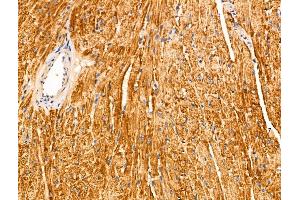 ABIN6265607 and ABIN6266680 at 1/100 staining Mouse heart tissue by IHC-P. (ANO9 Antikörper  (Internal Region))