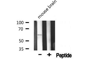 Western blot analysis of Phospho-AKT1(Thr308) expression in Mouse brain lysate (AKT1 Antikörper  (pThr308))