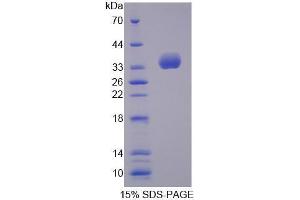 Image no. 1 for Tubulin Folding Cofactor B (TBCB) (AA 1-244) protein (His tag) (ABIN5665276) (TBCB Protein (AA 1-244) (His tag))