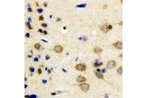 Immunohistochemical analysis of Synapsin 1 staining in human brain formalin fixed paraffin embedded tissue section.