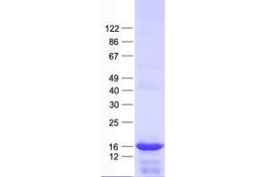 PRELID2 Protein (His tag)