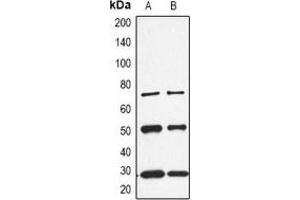 Western blot analysis of CALB1 expression in K562 (A), rat kidney (B) whole cell lysates. (CALB1 Antikörper  (C-Term))