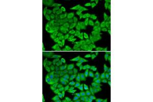 Immunofluorescence analysis of U2OS cells using MDH2 antibody. (MDH2 Antikörper  (AA 59-338))