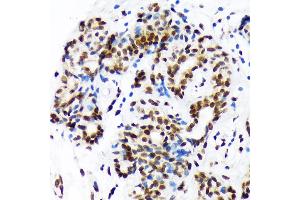 Immunohistochemistry (IHC) image for anti-DEK Oncogene (DEK) antibody (ABIN7266724)