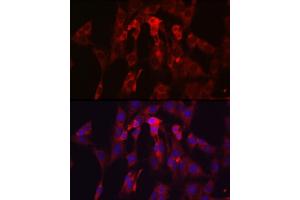 Immunofluorescence analysis of C6 cells using TIMP2 Rabbit pAb (ABIN3022132, ABIN3022133, ABIN1513608, ABIN1514751 and ABIN6218618) at dilution of 1:250 (40x lens). (TIMP2 Antikörper  (AA 100-200))