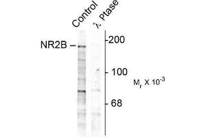 Image no. 1 for anti-Glutamate Receptor, Ionotropic, N-Methyl D-Aspartate 2B (GRIN2B) (pTyr1252) antibody (ABIN372685) (GRIN2B Antikörper  (pTyr1252))