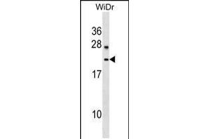 Western blot analysis in WiDr cell line lysates (35ug/lane). (LYZL6 Antikörper  (AA 37-65))
