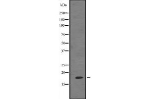 Western blot analysis of HES5 expression in 293 cell lysate ,The lane on the left is treated with the antigen-specific peptide. (HES5 Antikörper  (Internal Region))